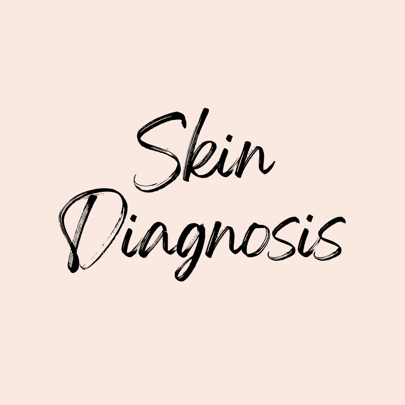 Skin Diagnosis